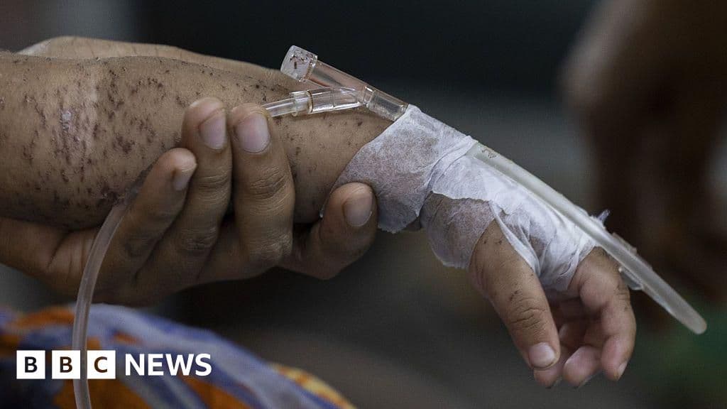 Shocking Measles Outbreak Claims Lives of Hundreds in Bangladesh