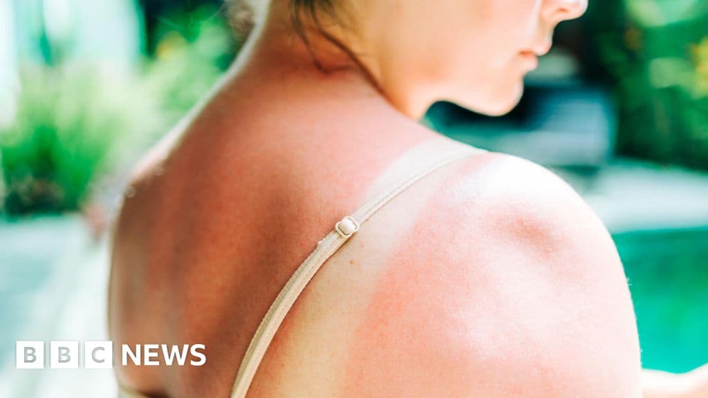 Shocking Spike: UK Melanoma Cases Hit Record High