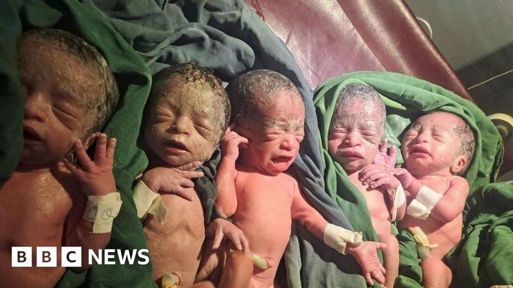 Shocking Joy: Ethiopian Woman Welcomes Rare Quintuplets