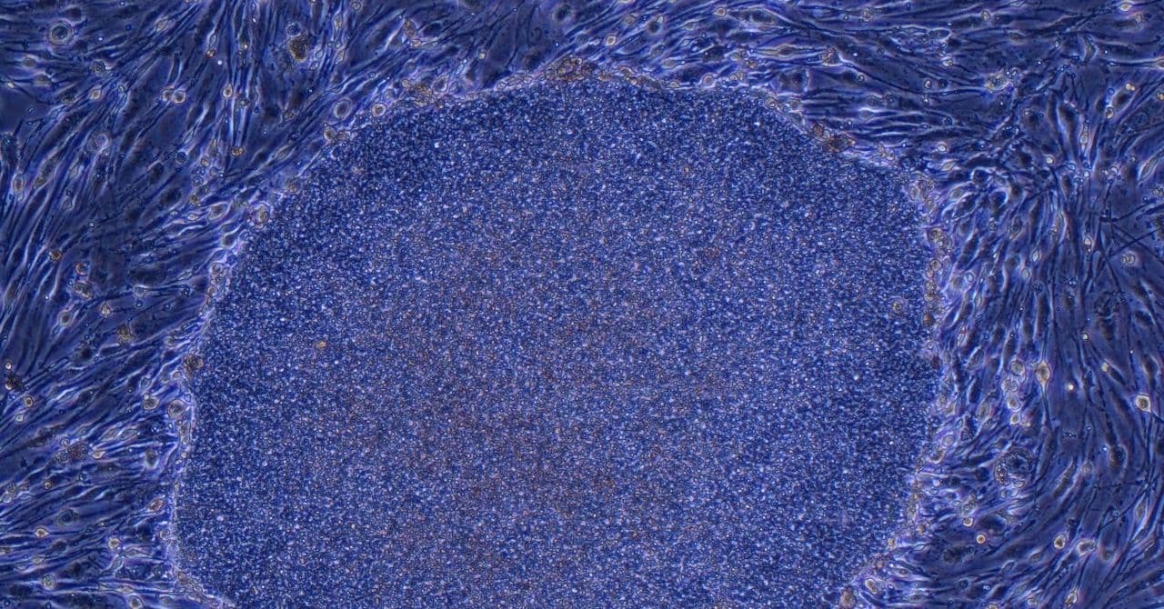 Japan Launches Groundbreaking Treatment Using Reprogrammed Cells