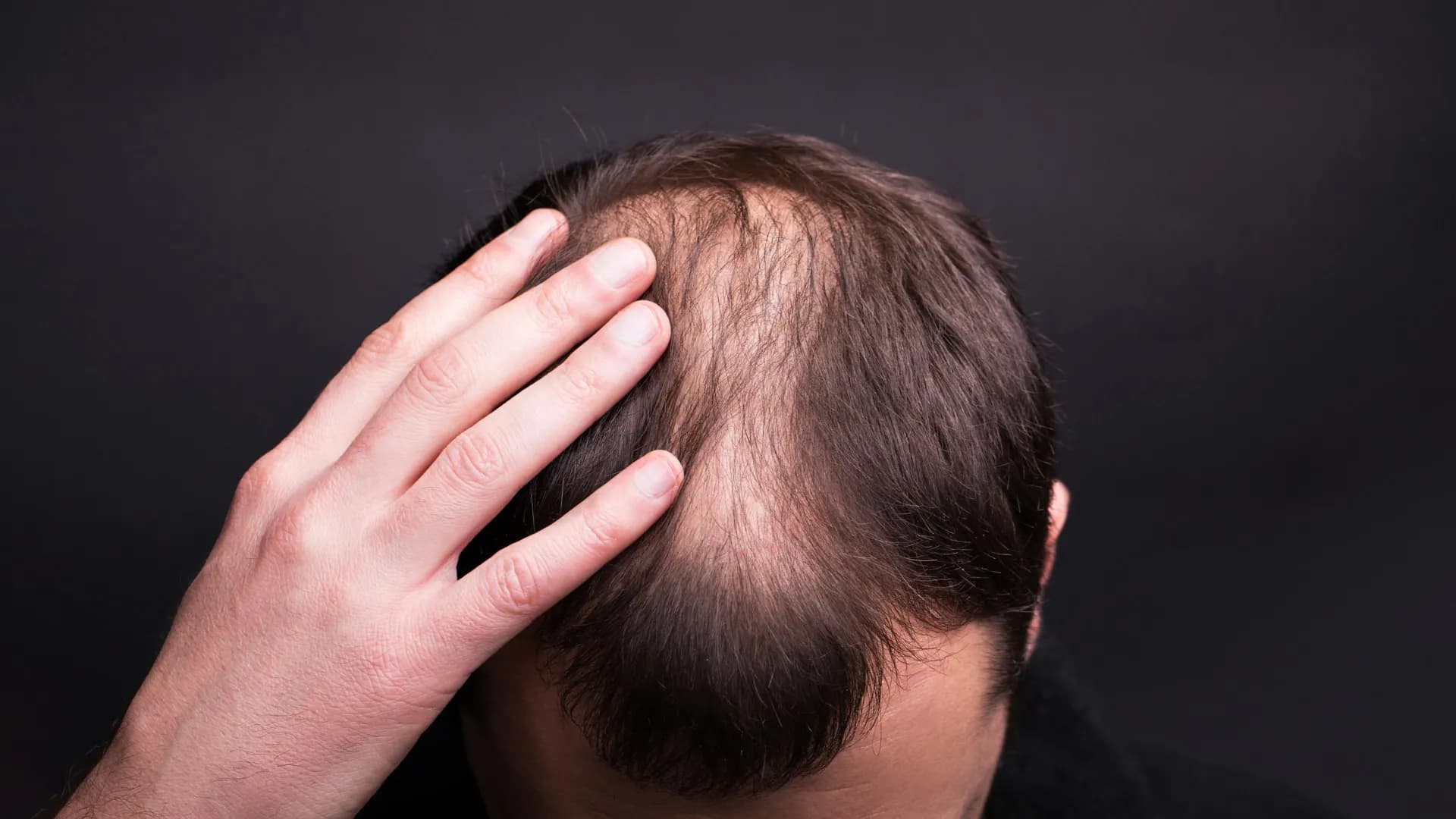 Shocking Discovery: How Human Hair Truly Grows Revealed