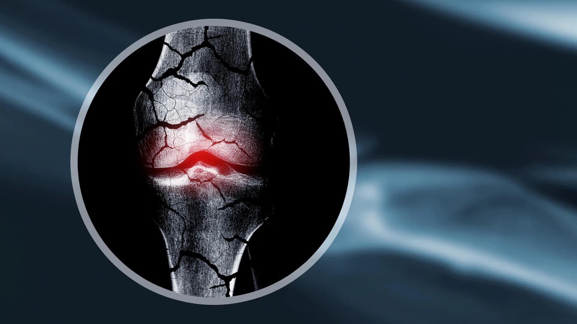 Shocking Study Reveals PFAS Chemicals May Harm Children’s Bones