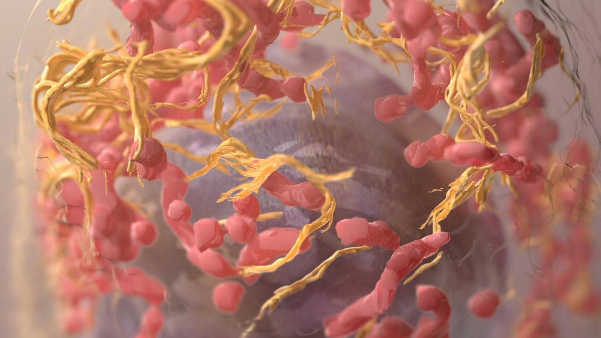 Cholesterol Revealed as Key Factor in Melanoma Spread